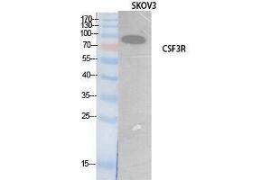 Western Blotting (WB) image for anti-Colony Stimulating Factor 3 Receptor (Granulocyte) (CSF3R) (Internal Region) antibody (ABIN3181067) (CSF3R Antikörper  (Internal Region))