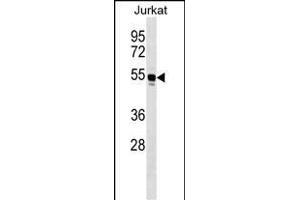 WARS Antibody (C-term) (ABIN1536896 and ABIN2849624) western blot analysis in Jurkat cell line lysates (35 μg/lane). (WARS Antikörper  (C-Term))