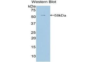 Detection of Recombinant LAMb3, Human using Polyclonal Antibody to Laminin Beta 3 (LAMb3) (Laminin beta 3 Antikörper  (AA 352-587))