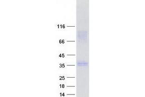 Validation with Western Blot