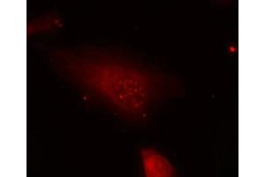 Immunofluorescence staining of methanol-fixed Hela cells using FKHR(Phospho-Ser319) Antibody. (FOXO1 Antikörper  (pSer319))