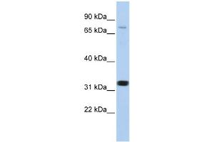 WB Suggested Anti-CACNB2 Antibody Titration:  0. (CACNB2 Antikörper  (N-Term))