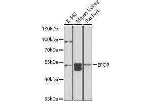 Western blot analysis of extracts of various cell lines, using EPOR antibody (ABIN3016975, ABIN3016976, ABIN1679740, ABIN1679741 and ABIN6219913) at 1:1000 dilution. (EPOR Antikörper  (AA 274-508))