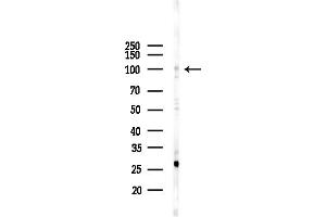 Western blot analysis of lysates from COLO205 cells(UV,30 min treatment), using C3 Antibody at 1/1000 dilution.