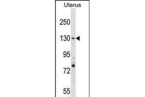 RFC1 Antibody (N-term) (ABIN1539238 and ABIN2838143) western blot analysis in Uterus tissue lysates (35 μg/lane).