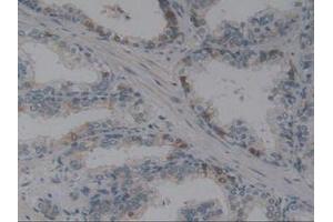IHC-P analysis of Human Prostate Gland Tissue, with DAB staining. (Angiotensin I Converting Enzyme 1 Antikörper  (AA 1160-1306))