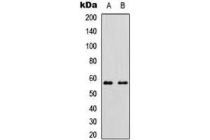 Western blot analysis of Cytochrome P450 11B2 expression in HEK293T (A), Raw264. (Cytochrome P450 11B2 (Center) Antikörper)