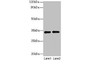 Western blot All lanes: Rgn antibody at 8 μg/mL Lane 1: A549 whole cell lysate Lane 2: HCT116 whole cell lysate Secondary Goat polyclonal to rabbit IgG at 1/10000 dilution Predicted band size: 34 kDa Observed band size: 34 kDa (Regucalcin Antikörper  (AA 1-299))