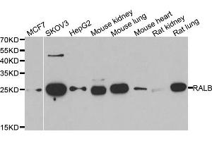 Western blot analysis of extracts of various cell lines, using RALB antibody.