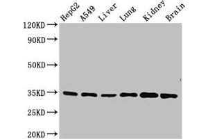 Western Blot Positive WB detected in: HepG2 whole cell lysate, A549 whole cell lysate, Mouse liver tissue, Mouse lung tissue, Mouse kidney tissue, Mouse brain tissue All lanes: GFRA2 antibody at 3. (GFRA2 Antikörper  (AA 242-415))