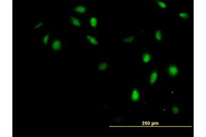 Immunofluorescence of purified MaxPab antibody to GTF2H4 on HeLa cell. (GTF2H4 Antikörper  (AA 1-462))