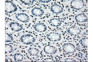 Immunohistochemical staining of paraffin-embedded colon tissue using anti-BRAFmouse monoclonal antibody. (BRAF Antikörper)