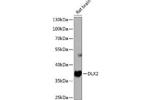Western blot analysis of extracts of rat brain, using DLX2 antibody  at 1:1000 dilution. (DLX2 Antikörper  (AA 1-140))