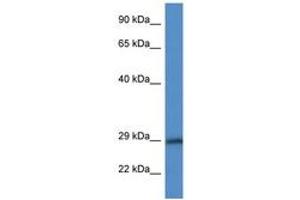 Image no. 1 for anti-Hydroxyprostaglandin Dehydrogenase 15-(NAD) (HPGD) (AA 67-116) antibody (ABIN6747588)