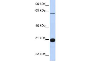 WB Suggested Anti-RALGPS1 Antibody Titration:  0. (RALGPS1 Antikörper  (Middle Region))