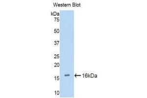 Western Blotting (WB) image for anti-Cubilin (Intrinsic Factor-Cobalamin Receptor) (CUBN) (AA 3511-3623) antibody (ABIN1858562) (CUBN Antikörper  (AA 3511-3623))