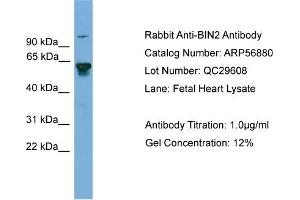 WB Suggested Anti-BIN2  Antibody Titration: 0. (BIN2 Antikörper  (Middle Region))