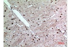 Immunohistochemistry (IHC) analysis of paraffin-embedded Rat Brain, antibody was diluted at 1:100. (KRT14 Antikörper  (C-Term))