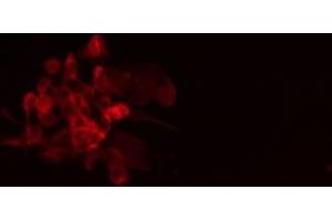 Immunofluorescence (fixed cells) (IF/ICC) image for anti-PTPRF Interacting Protein, Binding Protein 1 (Liprin beta 1) (PPFIBP1) (Internal Region) antibody (ABIN6259608)