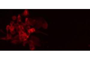 ABIN6275729 staining A549 cells by IF/ICC. (PPFIBP1 Antikörper  (Internal Region))