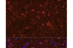 Immunofluorescence analysis of Rat brain using GAD2 Polyclonal Antibody at dilution of 1:100 (40x lens). (GAD65 Antikörper)