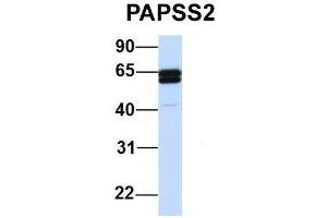 Host:  Rabbit  Target Name:  PAPSS2  Sample Type:  Human 721_B  Antibody Dilution:  1.