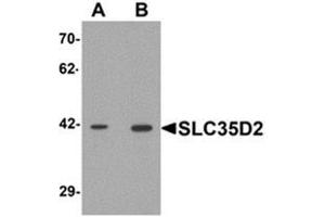 Western blot analysis of SLC35D2 in HeLa cell lysate with SLC35D2 Antibody  at (A) 1 and (B) 2 μg/ml. (Solute Carrier Family 35 (UDP-GlcNAc/UDP-Glucose Transporter), Member D2 (SLC35D2) (C-Term) Antikörper)