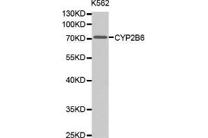 Western Blotting (WB) image for anti-Cytochrome P450, Family 2, Subfamily B, Polypeptide 6 (CYP2B6) (AA 160-340) antibody (ABIN6218554) (CYP2B6 Antikörper  (AA 160-340))