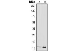 Western blot analysis of IFN gamma expression in MOLT4 (A), Jurkat (B) whole cell lysates. (Interferon gamma Antikörper  (Center))