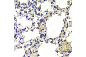 Immunohistochemistry of paraffin-embedded mouse lung using HDAC5 antibody (ABIN6290464) at dilution of 1:100 (40x lens).