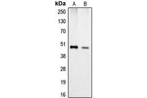 Western blot analysis of Carboxypeptidase A1 expression in Jurkat (A), HeLa (B) whole cell lysates. (CPA1 Antikörper  (Center))