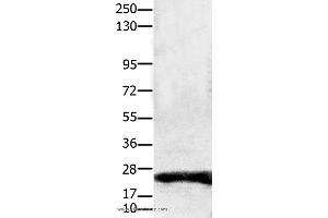 Western blot analysis of Hela cell, using CLDN1 Polyclonal Antibody at dilution of 1:1900 (Claudin 1 Antikörper)