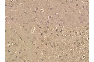 SND1 Mouse Monoclonal Antibody at 1/100 staining rat brain tissue by IHC-P. (SND1 Antikörper)