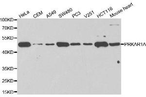 Western blot analysis of extracts of various cell lines using PRKAR1A antibody. (PRKAR1A Antikörper  (AA 1-250))