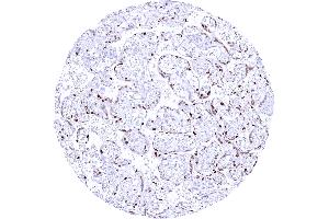 Mature placenta showing a strong Cyclin E1 staining of most cytotrophoblast cells (Rekombinanter Cyclin E1 Antikörper)