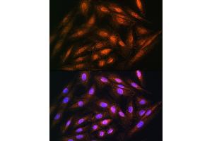Immunofluorescence analysis of H9C2 cells using DUSP14 Rabbit pAb (ABIN6127789, ABIN6139865, ABIN6139866 and ABIN6214482) at dilution of 1:100. (DUSP14 Antikörper  (AA 1-198))