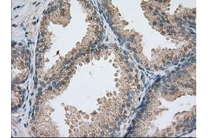 Immunohistochemical staining of paraffin-embedded colon tissue using anti-PDE4A mouse monoclonal antibody. (PDE4A Antikörper)