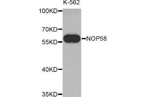 Western blot analysis of extracts of K-562 cell line, using NOP58 antibody. (NOP58 Antikörper  (AA 360-529))