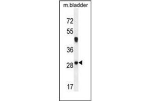 Western blot analysis of NCALD Antibody (C-term) in mouse bladder tissue lysates (35ug/lane).