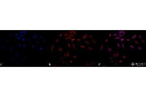 Immunocytochemistry/Immunofluorescence analysis using Mouse Anti-Hsp47 Monoclonal Antibody, Clone 1C4-1A6 . (SERPINH1 Antikörper)