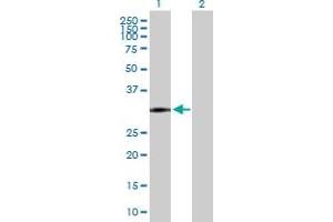 Lane 1: CD82 transfected lysate ( 29. (CD82 293T Cell Transient Overexpression Lysate(Denatured))