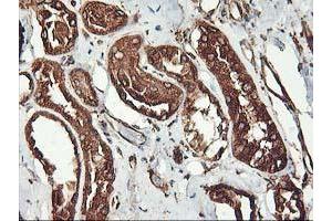 Immunohistochemical staining of paraffin-embedded Human Kidney tissue using anti-KCNAB1 mouse monoclonal antibody. (KCNAB1 Antikörper)