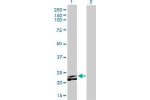 Western Blot analysis of FGF23 expression in transfected 293T cell line by FGF23 MaxPab polyclonal antibody. (FGF23 Antikörper  (AA 1-251))