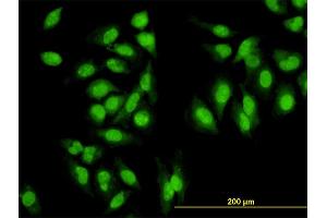 Immunofluorescence of monoclonal antibody to SYMPK on HeLa cell. (Symplekin Antikörper  (AA 1-533))