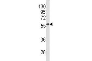 Western Blotting (WB) image for anti-Beclin 1, Autophagy Related (BECN1) (AA 95-132) antibody (ABIN3028503)