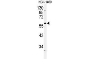 Western blot analysis of ADRA1B Antibody (Center) in NCI-H460 cell line lysates (35µg/lane). (ADRA1B Antikörper  (Middle Region))