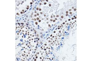 Immunohistochemistry of paraffin-embedded mouse testis using DGCR8 Rabbit pAb (ABIN7266761) at dilution of 1:200 (40x lens). (DGCR8 Antikörper)