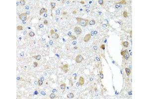 Immunohistochemistry of paraffin-embedded Rat brain using BAG5 Polyclonal Antibody at dilution of 1:100 (40x lens). (BAG5 Antikörper)