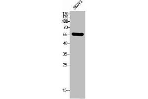 Western Blot analysis of SKOV3 cells using CD292 Polyclonal Antibody (BMPR1A Antikörper  (N-Term))