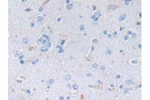 Detection of NES in Human Cerebrum Tissue using Polyclonal Antibody to Nestin (NES) (Nestin Antikörper  (AA 178-399))